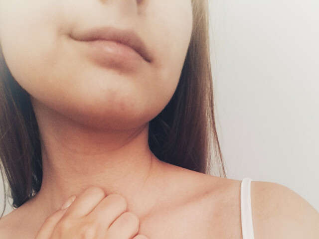 ENMASUNSHINE free sexy photo